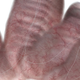 Illustration for article titled New Software Will Give Doctors a Panoramic View Inside Your Bladder